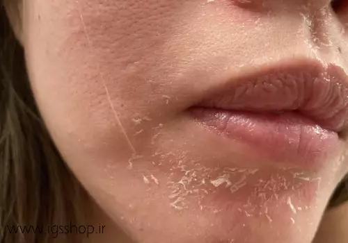 گالری تصاویر